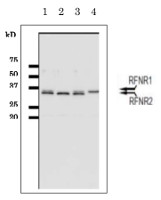 FNR | Ferredoxin  NADP Reductase (root) in the group Antibodies Plant/Algal  / Photosynthesis  / Electron transfer at Agrisera AB (Antibodies for research) (AS20 4436)